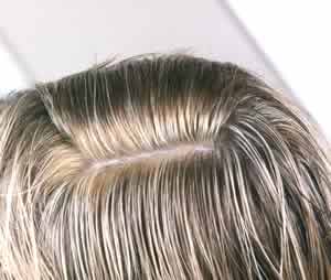 The problem is
color 'bleed-through'
on the scalp
on blonde hair The problem is
color 'bleed-through'
on the scalp
on blonde hair